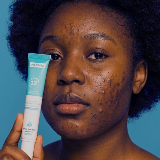 Gel Mooyam Anti-Acné Réparateur – Résultats visibles en 12h