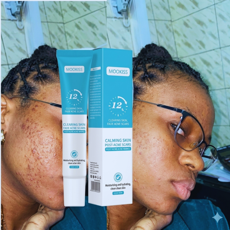 Gel Mooyam Anti-Acné Réparateur – Résultats visibles en 12h